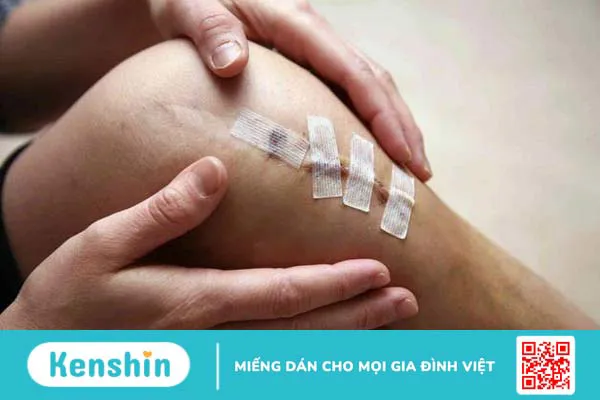 Những cách giúp ngăn ngừa thâm, sẹo sau phẫu thuật 1