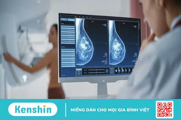 Những câu hỏi thường gặp về chụp nhũ ảnh bạn nhất định nên biết 4