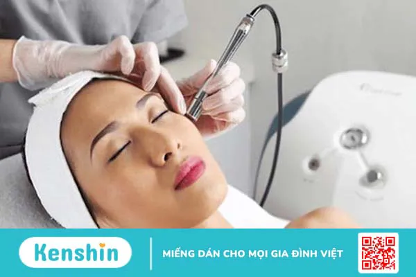 Nhung-dieu-can-biet-ve-ban-laser-tri-tham 2.webp