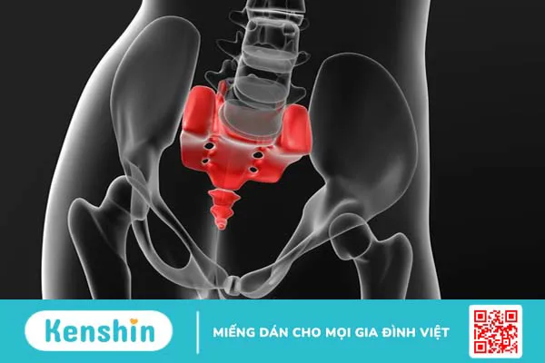 Những khối u vùng xương cụt thường gặp và phương pháp điều trị 1