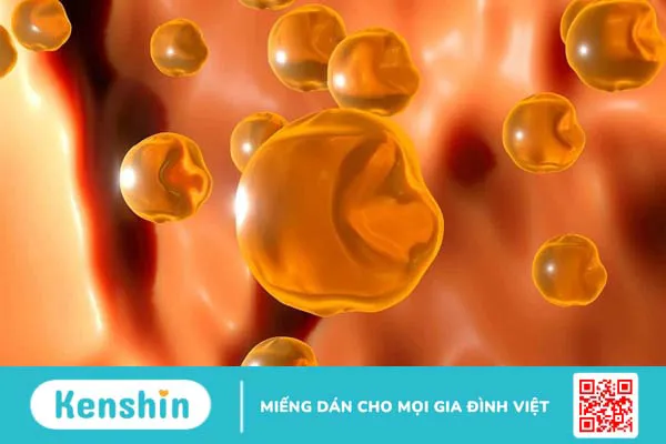 Những lầm tưởng về chất béo và cholesterol 2