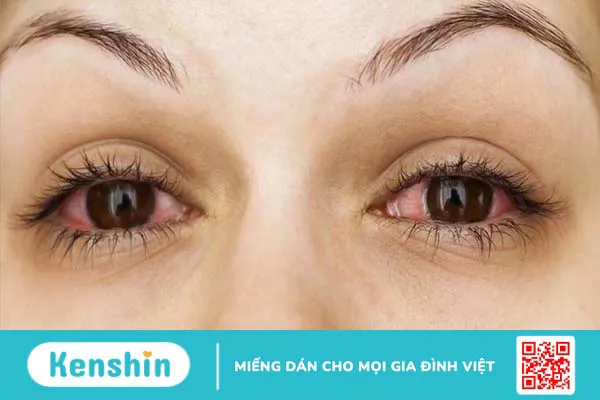 Tinh dầu có thể làm giảm viêm: Những loại tinh dầu tốt nhất và cách dùng hiệu quả 4