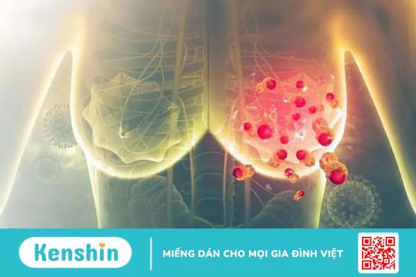 Những thay đổi khi tiêm hormone nam để chuyển đổi giới tính -3