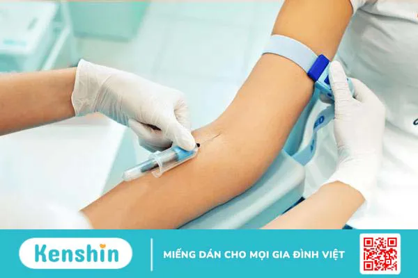 Những xét nghiệm máu không cần nhịn ăn và điều bạn cần lưu ý