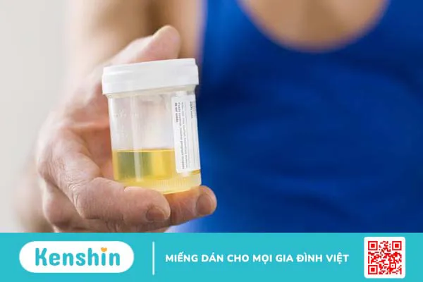 Nước tiểu để lâu có xét nghiệm được không? Khi nào cần xét nghiệm nước tiểu? 3