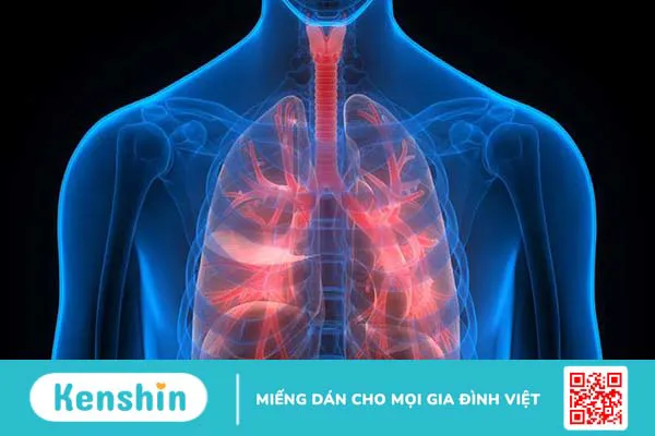 Phác đồ điều trị COPD Bộ y tế 2023-1