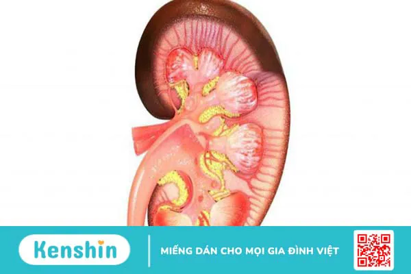 Phác đồ điều trị viêm mao mạch dị ứng ở trẻ em 2