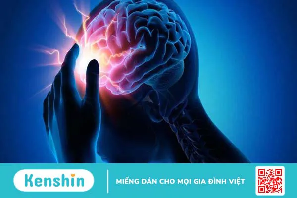 Đau đầu dữ dội có thể là dấu hiệu của tai biến mạch máu não