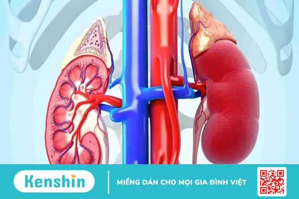 Phát hiện loại thuốc mới có khả năng làm giảm kích thước của u nang thận 3