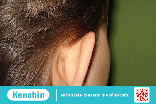 Phẫu thuật tiệt căn xương chũm là gì? Quy trình thực hiện như thế nào? 5