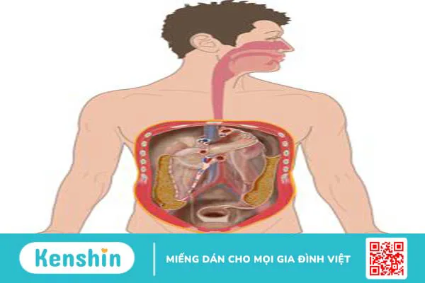 Phúc mạc là gì? Nguyên nhân gây viêm phúc mạc 3