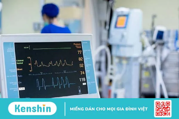 Phương pháp đo ECG là gì? Nguyên lý và quy trình các bước đo ECG 4