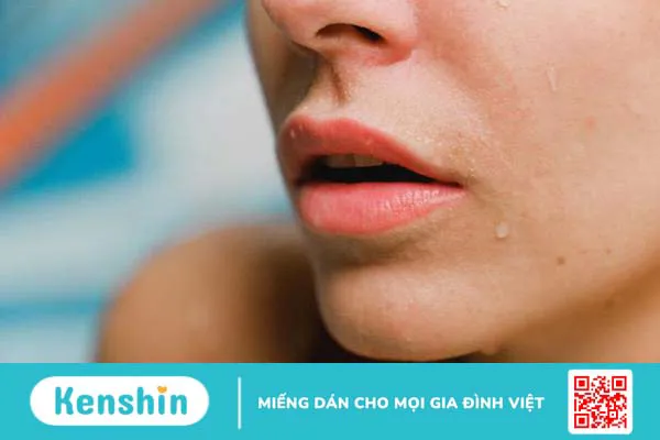 Phương pháp tiêm tan mỡ nọng cằm: Cơ chế, quá trình thực hiện và tác dụng phụ 4