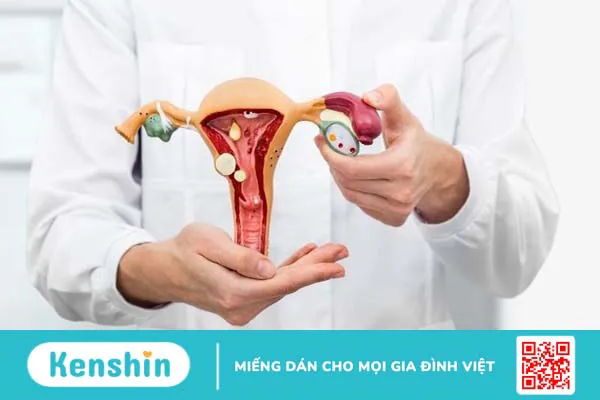 Polyp cổ tử cung có gây ung thư không? 1