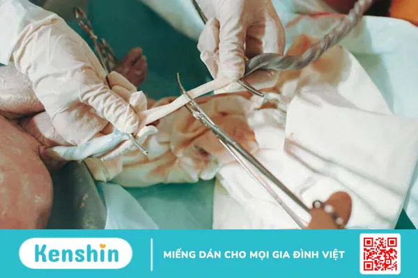 Quá trình rụng rốn ở trẻ sơ sinh và các vấn đề bố mẹ cần cảnh giác 2