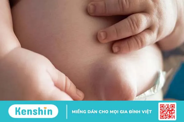 Quá trình rụng rốn ở trẻ sơ sinh và các vấn đề bố mẹ cần cảnh giác 4