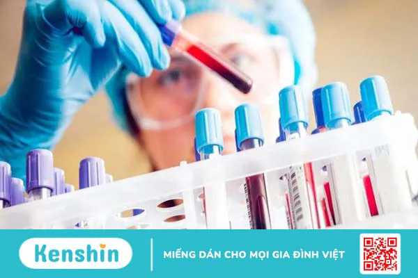 Quy trình thực hiện xét nghiệm hồng cầu lưới 1