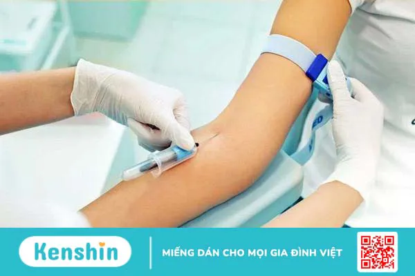 Quy trình thực hiện xét nghiệm hồng cầu lưới 2