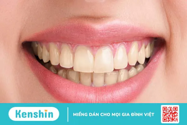 Răng kim cương là gì? Ưu điểm và quy trình gắn răng kim cương 2