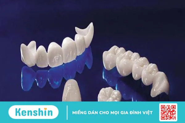 Răng sứ ceramill: Ưu nhược điểm và phân loại 1