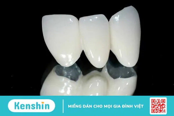 Răng sứ emax: Tổng quan, phân loại và ứng dụng trong nha khoa 2