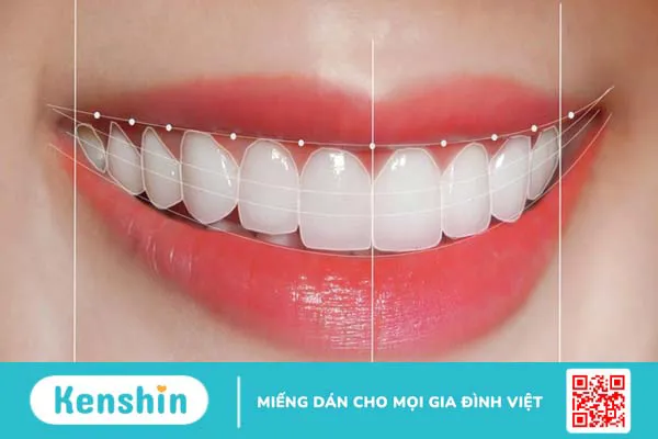 Răng sứ emax: Tổng quan, phân loại và ứng dụng trong nha khoa 3