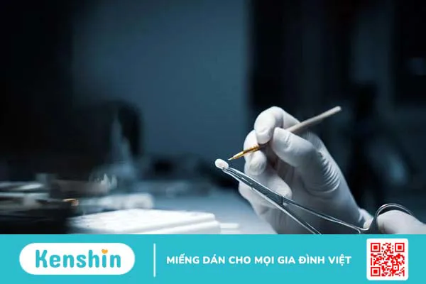 Răng sứ kim cương là gì? Ưu và nhược điểm của loại răng này 3