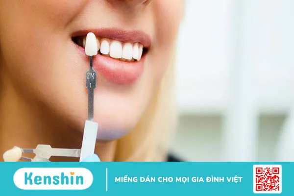 Răng sứ kim cương là gì? Ưu và nhược điểm của loại răng này 4