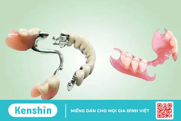 Răng tháo lắp Composite là gì và có ưu điểm gì? 0