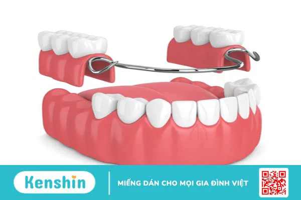 Răng tháo lắp Composite có độ an toàn và độ bền cao