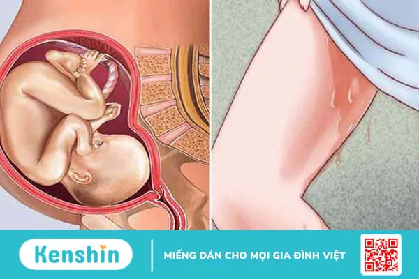 Rỉ ối 3 tháng giữa cần phải làm gì?1