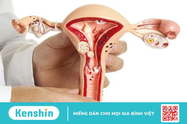 Rong kinh tuổi dậy thì: Những điều cần biết 3