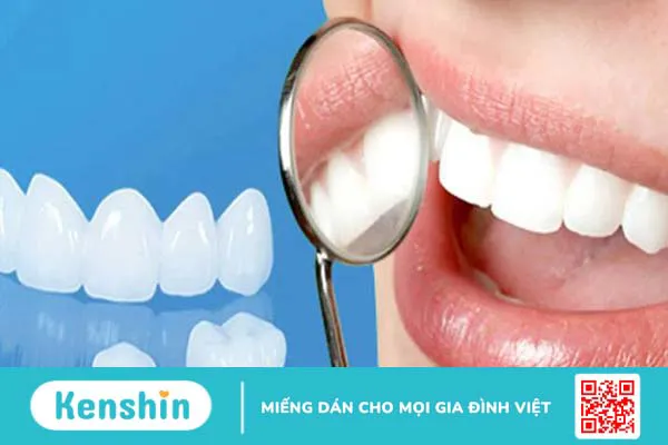 Sâu kẽ răng cửa: Nguyên nhân và cách điều trị 3