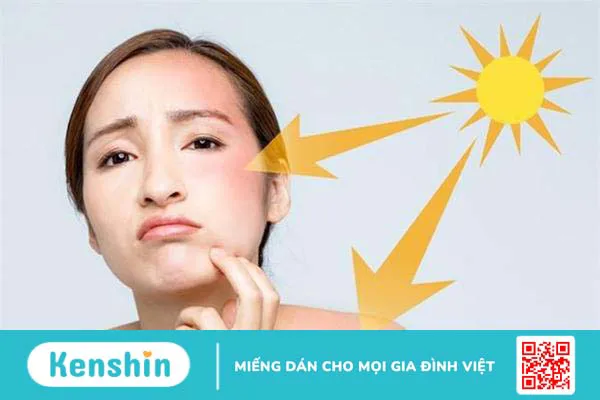 Chọn kem chống nắng có chỉ số SPF và PA phù hợp để tránh tình trạng bí da