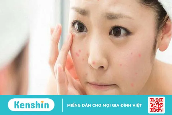 Bôi kem chống nắng một lượng vừa đủ và kể cả khi trong nhà hay bóng râm