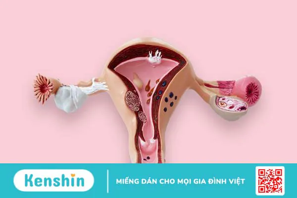 Siêu âm phụ khoa là gì? Mục đích của siêu âm phụ khoa 3