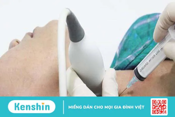 Khi nào cần sinh thiết tuyến giáp? Sinh thiết tuyến giáp bao lâu có kết quả? 3