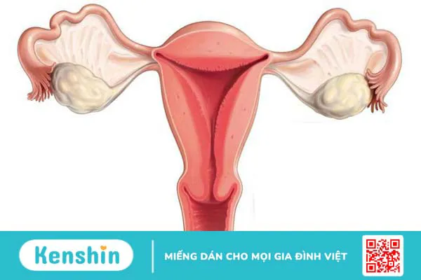 Góc giải đáp: Sờ thấy cục ở cổ tử cung là bị gì? 1