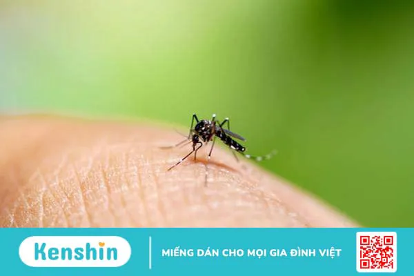 Những biến chứng cực kỳ nghiêm trọng của sốt xuất huyết thường do virus dengue