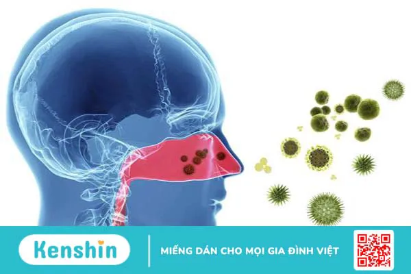 Bệnh lý đường hô hấp luôn đa dạng về bệnh cũng như triệu chứng, và rất dễ mắc phải