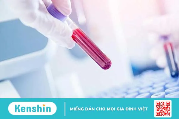 Tại sao cần làm xét nghiệm GBS? Ý nghĩa của xét nghiệm GBS đối với phụ nữ có thai như thế nào?+5