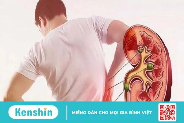 Tại sao đái tháo đường gây suy thận? Biến chứng trên thận có nguy hiểm không? 2