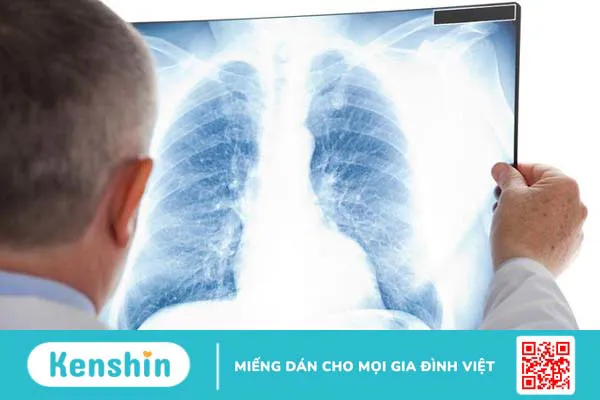 Hỏi đáp: Tầm soát ung thư bao nhiêu tiền? 3