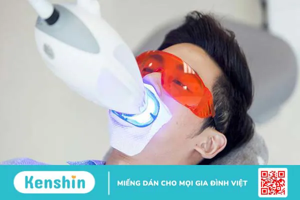 Tẩy trắng răng bằng ánh sáng xanh là như thế nào?3