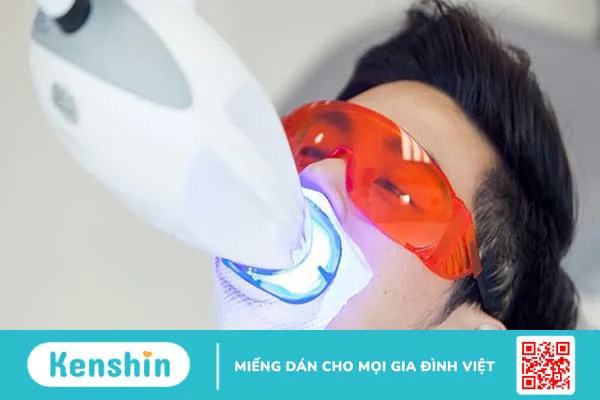 Tẩy trắng răng mất bao lâu thì đạt hiệu quả 3