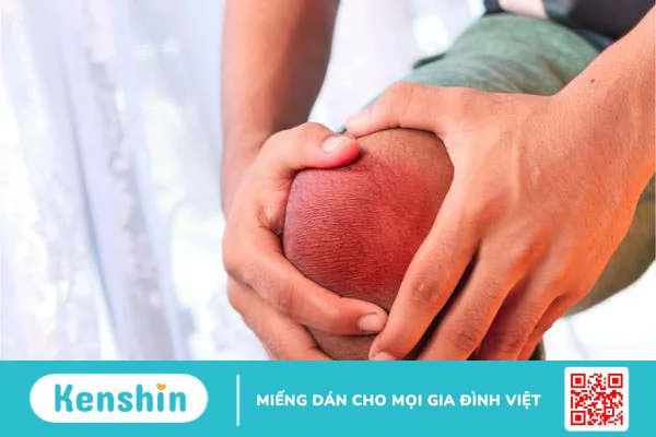 Tế bào gốc trung mô từ dây rốn: Nguồn gốc, ưu điểm và ứng dụng 4