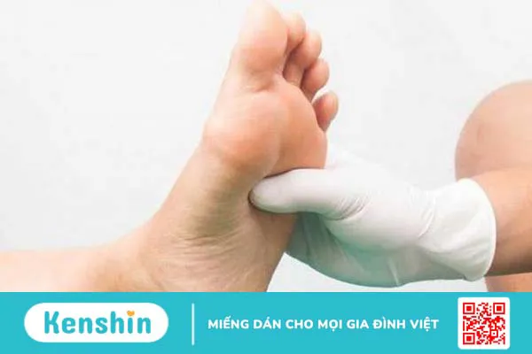 Tê lòng bàn chân: Nguyên nhân và cách điều trị hiệu quả 2