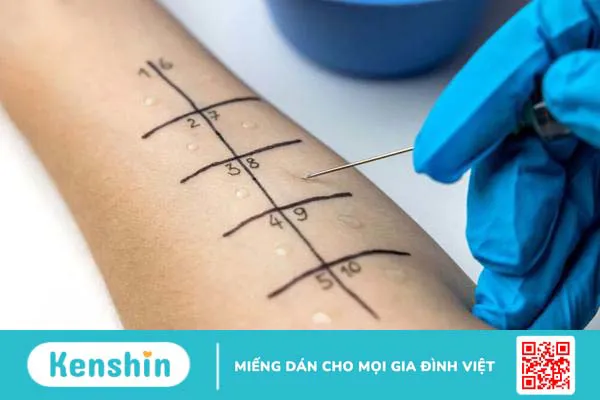 Test dị nguyên là gì? Tại sao cần thực hiện? Quy trình ra sao? 1