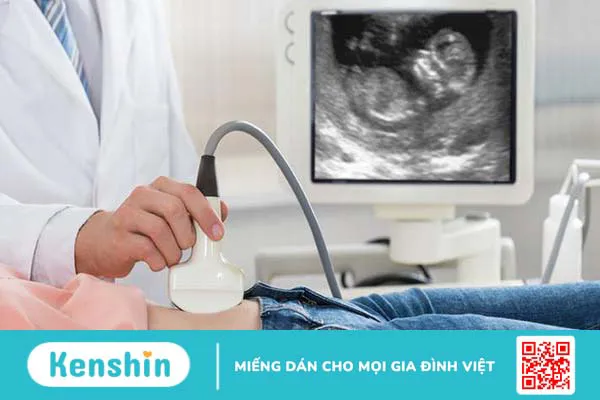 Thai 8 tuần nhịp tim 176 la trai hay gái? 2