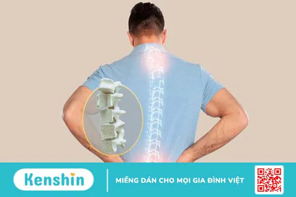 Thiếu xương là bệnh gì? Nguyên nhân và cách khắc phục 5